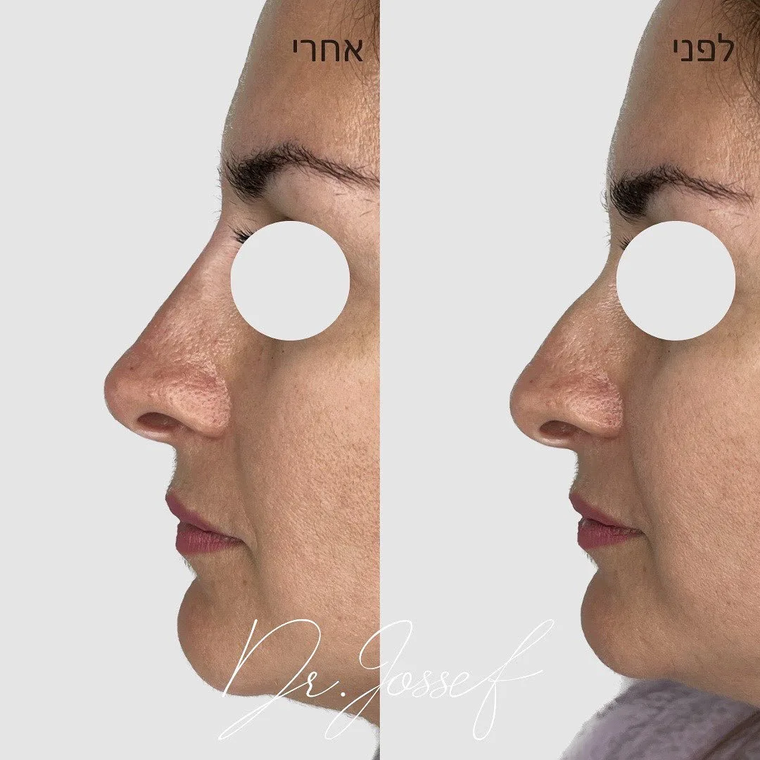 347236712_792325489284279_3589441532498506043_n