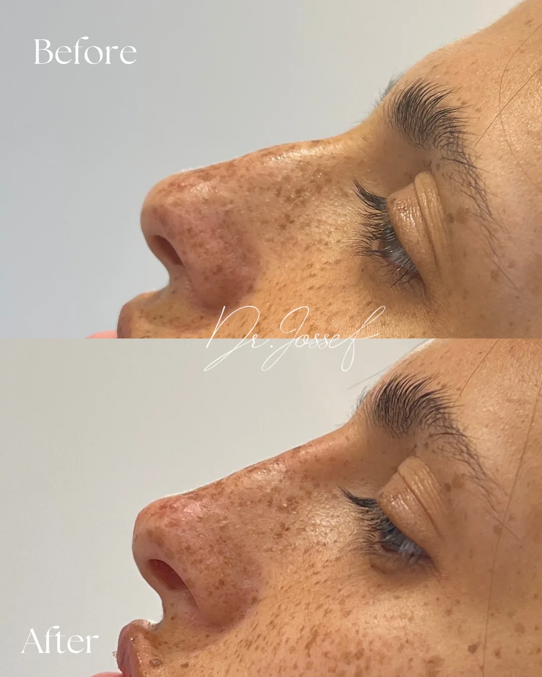 Facial and dental aesthetics