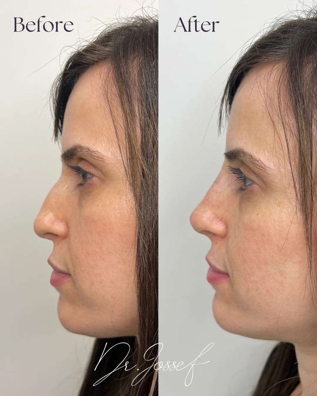 {"ARInfo":{"IsUseAR":false},"Version":"1.0.0","MakeupInfo":{"IsUseMakeup":false},"FaceliftInfo":{"IsChangeEyeLift":false,"IsChangeFacelift":false,"IsChangePostureLift":false,"IsChangeNose":false,"IsChangeFaceChin":false,"IsChangeMouth":false,"IsChangeThinFace":true},"BeautyInfo":{"SwitchMedicatedAcne":false,"IsAIBeauty":false,"IsBrightEyes":false,"IsSharpen":false,"IsOldBeauty":false,"IsReduceBlackEyes":false},"HandlerInfo":{"AppName":2},"FilterInfo":{"IsUseFilter":false}}